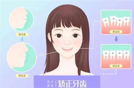 成都圣贝牙科与新桥口腔医院实力PK！详细收费清单对比