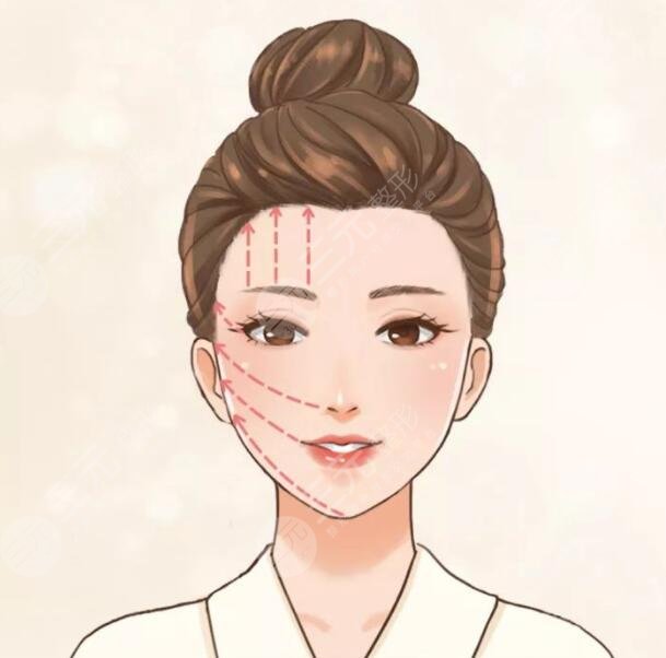 轮廓固定是什么手术？技术原理分析|抗衰新选择是否值得一试？