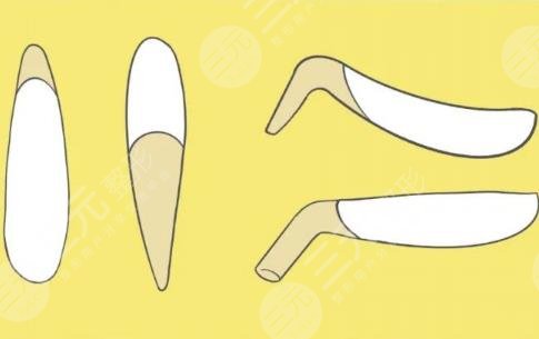 武汉张继强擅长项目