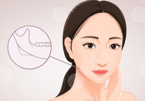 轮廓固定提升能保持多久