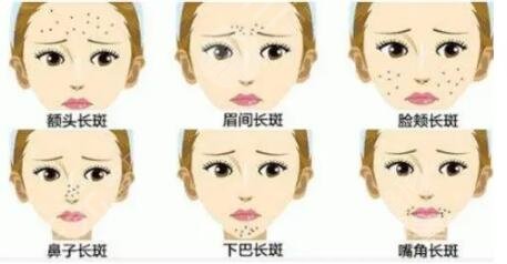 简单的祛斑方法有哪几种见效快?