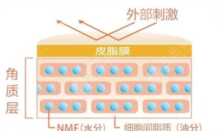角质