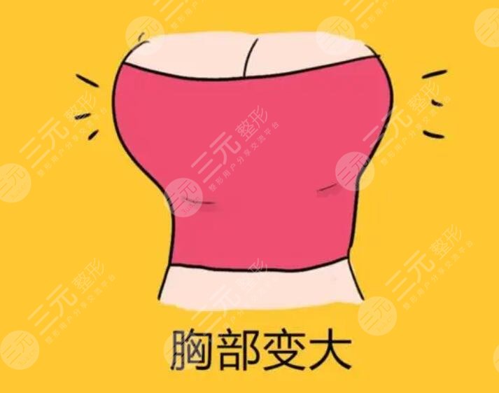 娜绮丽假体