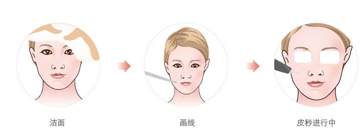 没有明显炎症和感染