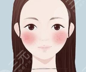 红血丝