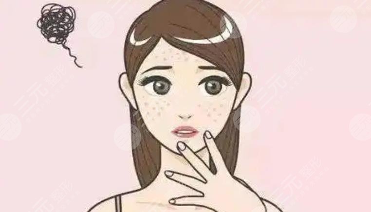 牛奶美白祛斑