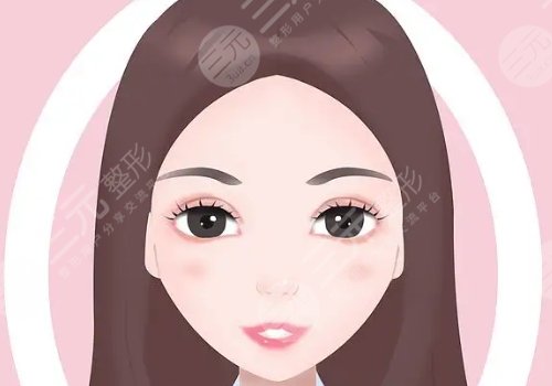 法令纹填充胶原蛋白还是玻尿酸好?