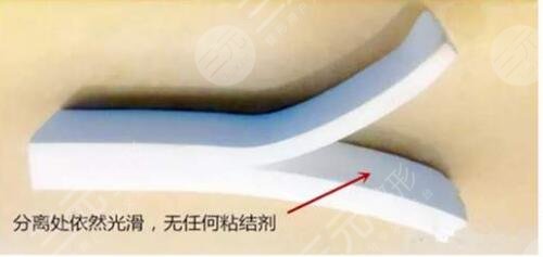 膨体隆鼻的副作用有哪些?