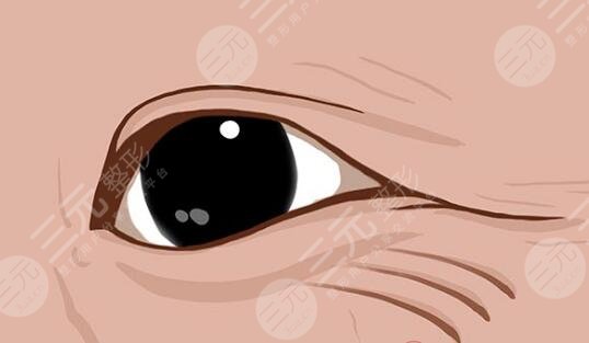 眼部细纹形成的原因是什么呢?