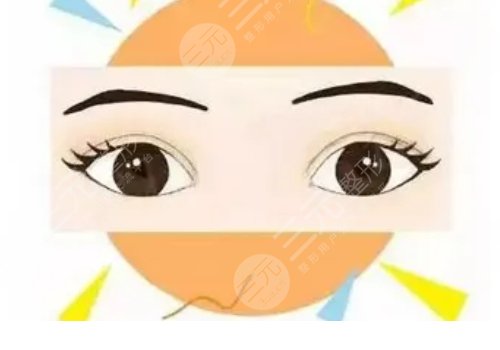 做双眼皮多少钱全切手术费用
