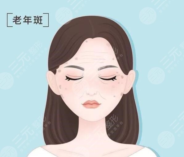老年斑是怎样形成的?