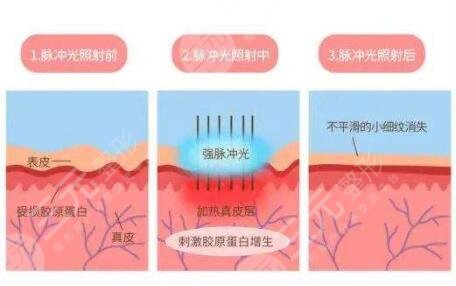 皮肤美容的技术手段有哪些?