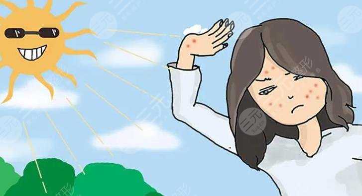 脸部过敏