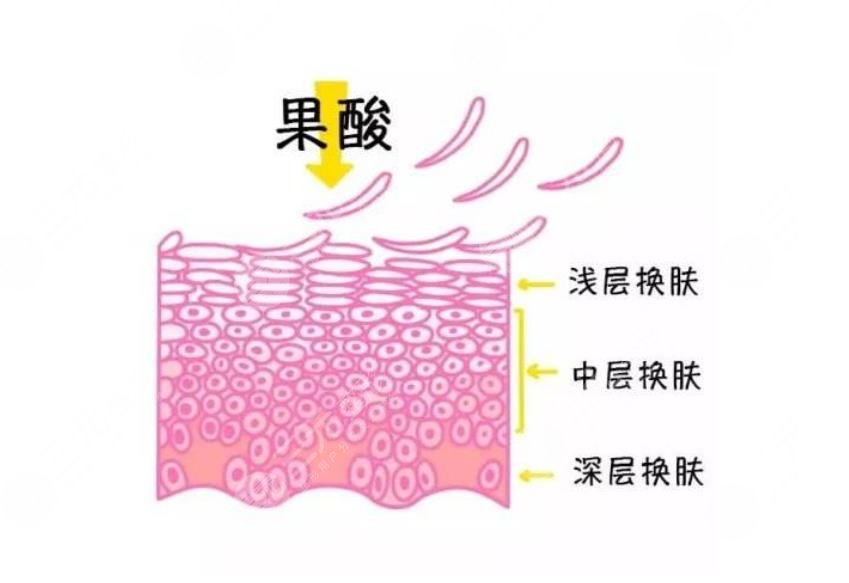 果酸的作用，什么是果酸?