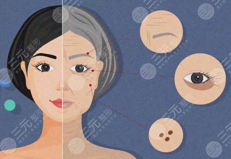 怎样消除脸上的皱纹快速且有？不妨照着文中几点做，果很惊艳！
