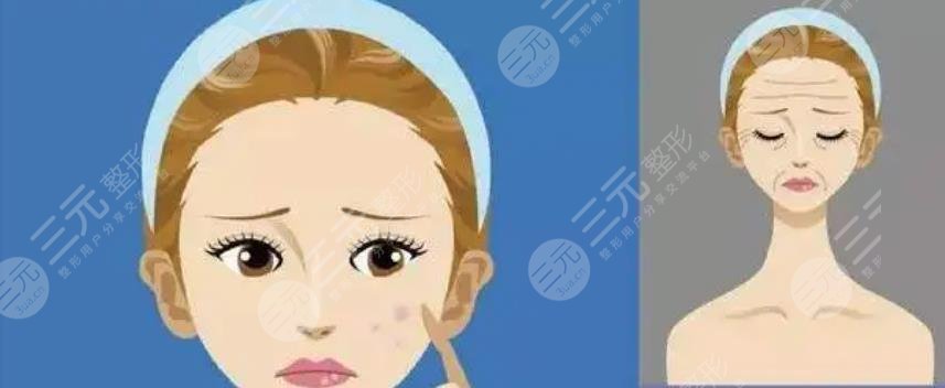 激光嫩肤