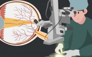哈尔滨市第七医院激光矫正近视眼价格多少?技术优点&案例反馈
